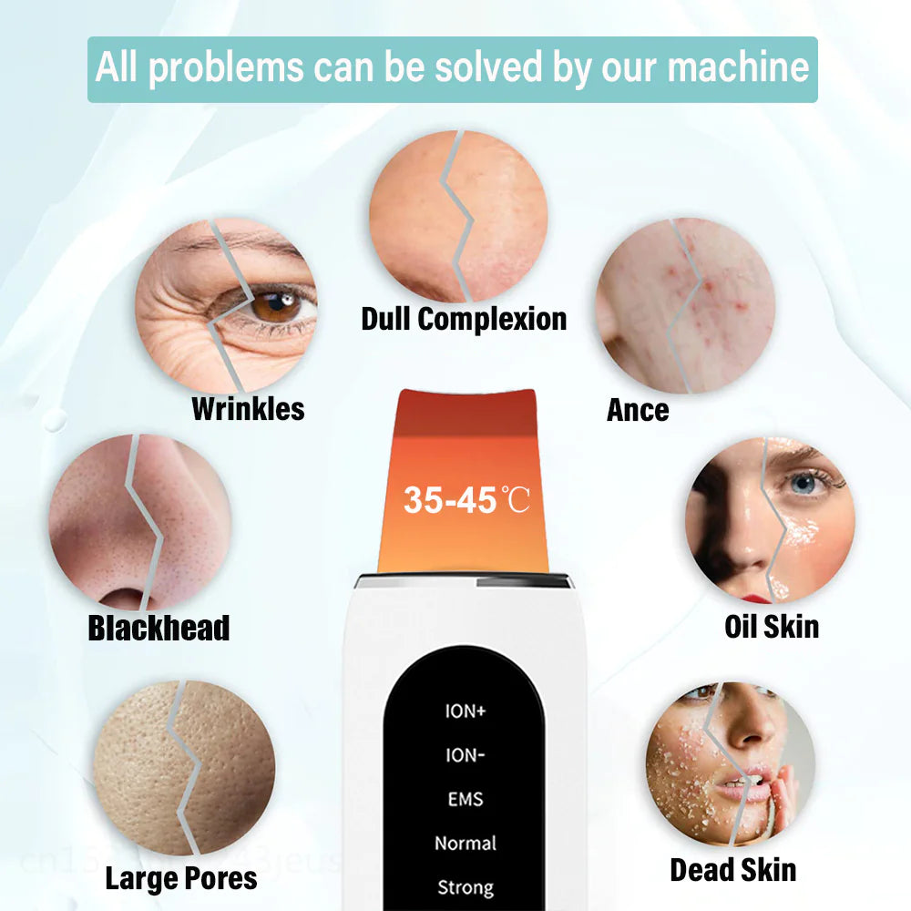 Ultrasonic Blackhead Remover & Skin Rejuvenation Device Velura