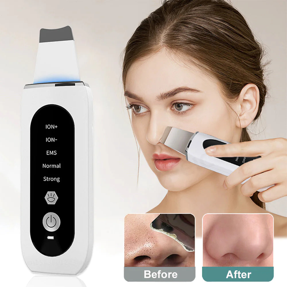 Ultrasonic Blackhead Remover & Skin Rejuvenation Device Velura